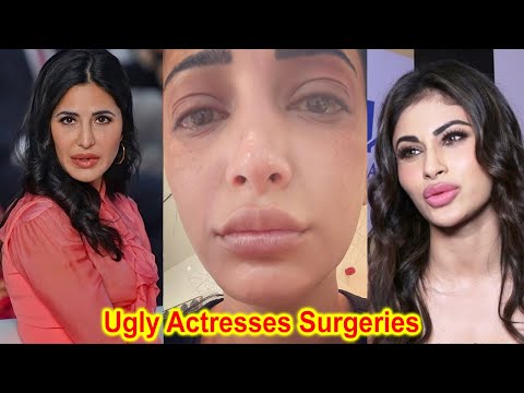 Ugly Surgeries of Bollywood Actresses After gaining popularity | Katrina Kaif | Mouni Roy | Shruti