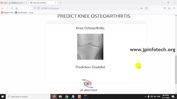 A Novel Method to Predict Knee Osteoarthritis using Deep Learning | Python Final Year Project