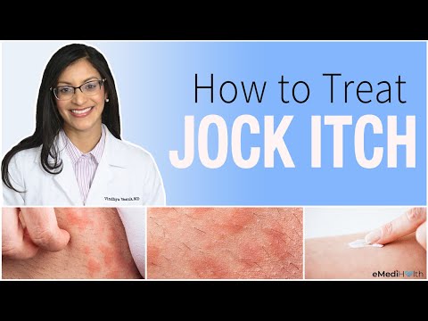 jock-itch-treatment,-prevention,-causes,-and-home-care-tips