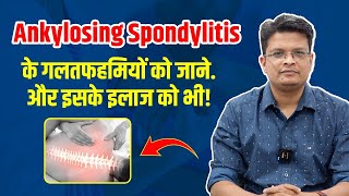 Ankylosing Spondylitis के मरीजों को ये बातें ज़रूर जाननी चाहिए  | Dr. Akash Khune