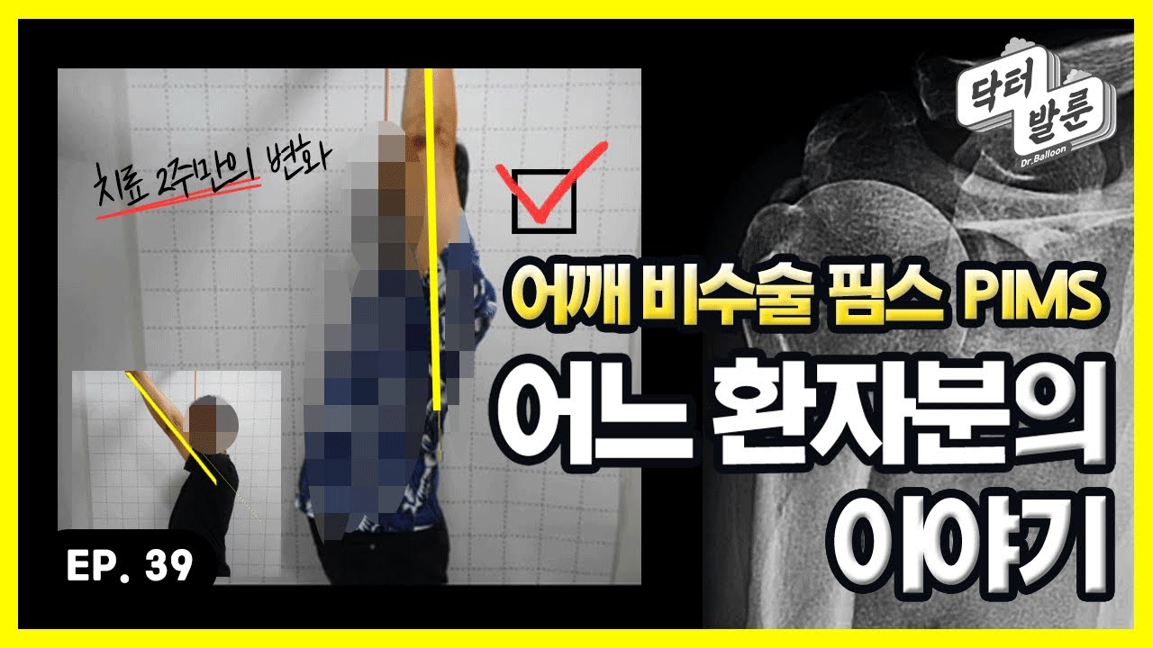 【환자사례】 이럴 때 핌스(PIMS) 치료가 효과적입니다. 핌스(PIMS)치료 두 번째 이야기ㅣ닥발TV