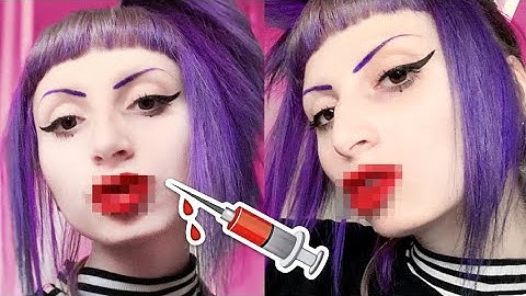 Ho fatto il FILLER ALLE LABBRA