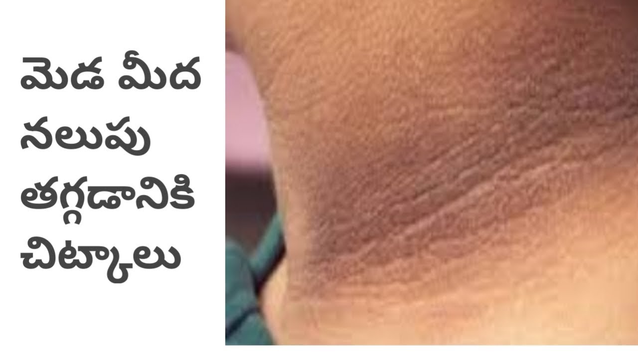 How to Get Rid of Dark neck in Telugu/Natural home remedies for black neck. - YouTube