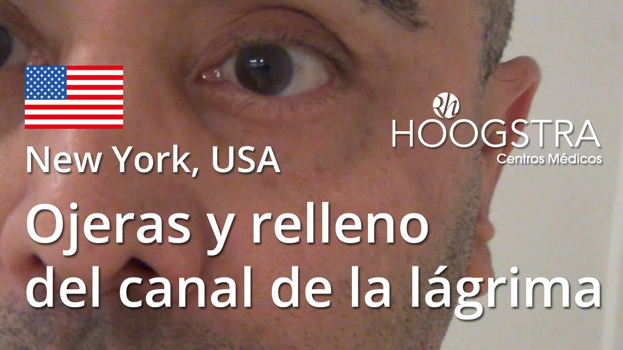 relleno para puff Ojeras y relleno del canal de la lágrima (16017)