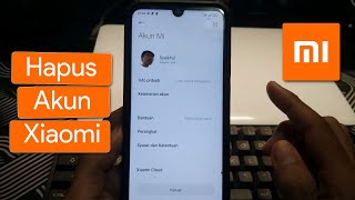 2 Cara Menghapus Akun Mi di Semua Hp Xiaomi