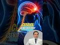 ¿DOLOR DE CABEZA UNA SEÑAL DE ALGO GRAVE? #cefalea