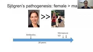 12/10/2021: Sjögren’s: Beyond the Basics
