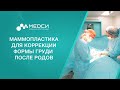 Маммопластика // Коррекция формы груди после родов #маммопластика #грудь  #медси