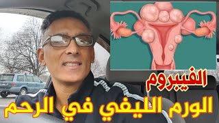 أورام الرحم الليفي, الفيبروم, Fibrome, Fibroid