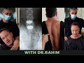 20 Years Upper Back Pain + Compensated Spine from Back Surgery HELPED! Dr. Rahim Chiropractic