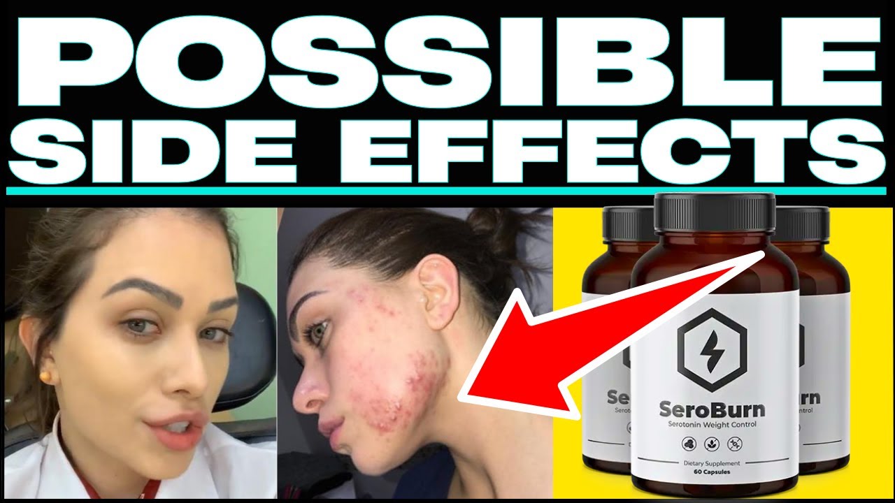 (😱❌BEWARE⛔🙀) Get Your FREE Bottle Of #SeroBurn???