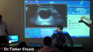 ESNT-CNE May 2014. US and Examination of kidney and AVF. Dr.Tamer Elsaid