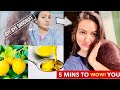 1 WASH CHALLENGE : Get Rid of EXTREME DANDRUFF & HAIR FALL Permanently At Home  | 100% Results