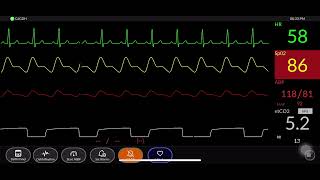 Simpl Simulated Patient Monitor screenshot 1