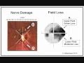 Glaucoma 1 Diagnosis