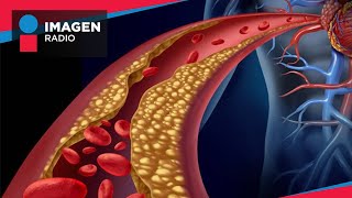 ¿Cuál es la diferencia entre los triglicéridos y el colesterol?