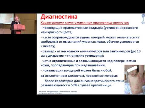 19.02.2017 - Клинические рекомендации: крапивница у детей