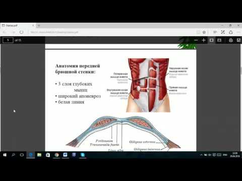 Открытая лекция на тему "2 см – норма или диастаз?"