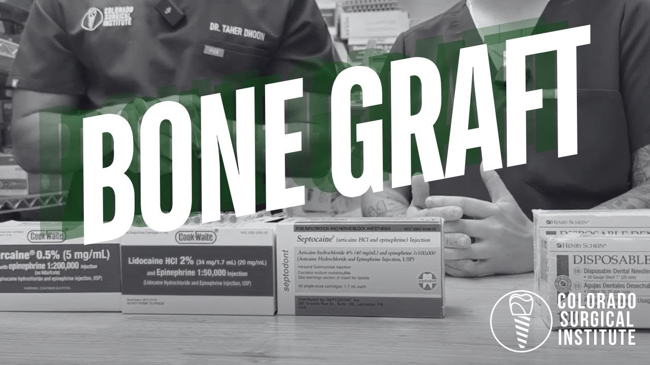 A Complete Guide to Dental Bone Grafting Materials: Applications, Techniques, Tools, and Tips