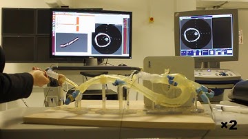 SCEM+: Real-time Robust Simultaneous Catheter and Environment Modelling for Endovascular Navigation