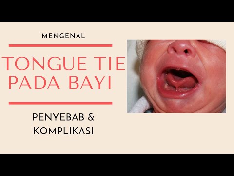 Video: Adakah Bayi Saya Melekatkan Lidahnya Tidak Biasa?