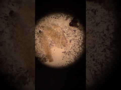 Video: Was ist ein parasitärer Wurm?