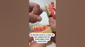 Why Does Your Gum Bleed When You Floss ⁉️# #oralhealth #dentalclinic #dentalcleaning #flossing