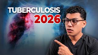 Tuberculosis 2026 | El tratamiento ya no es igual para todos