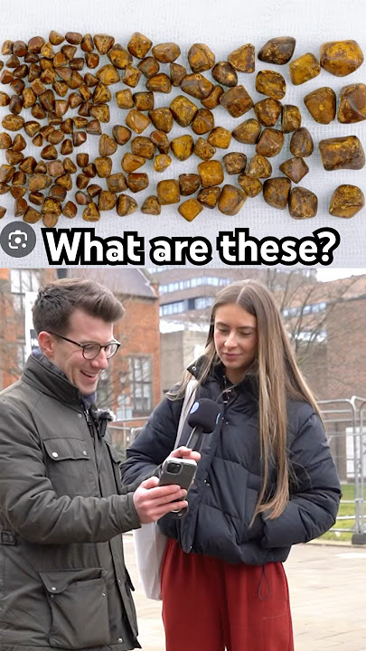 Doctor explains Gallstones … #shorts