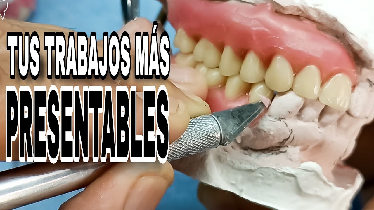 HASTA DÓNDE LIBERAR CUELLOS EN EL ENCERADO DE UNA PRÓTESIS DENTAL REMOVIBLE?