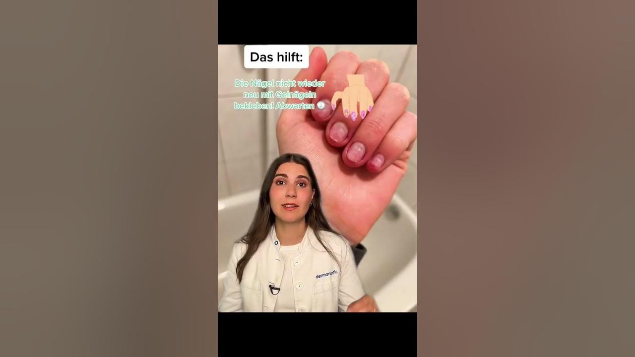 Kaputte Nägel nach Gelnägeln? 💅 │Dr. med. Alice Martin shorts YouTube