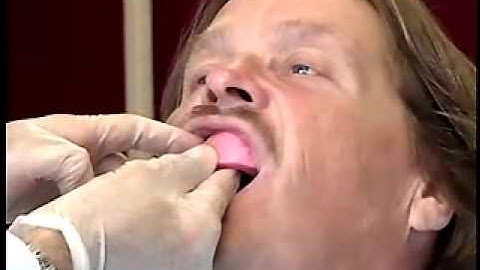 15 www.4dent.net - Determining Plane of Occlusion