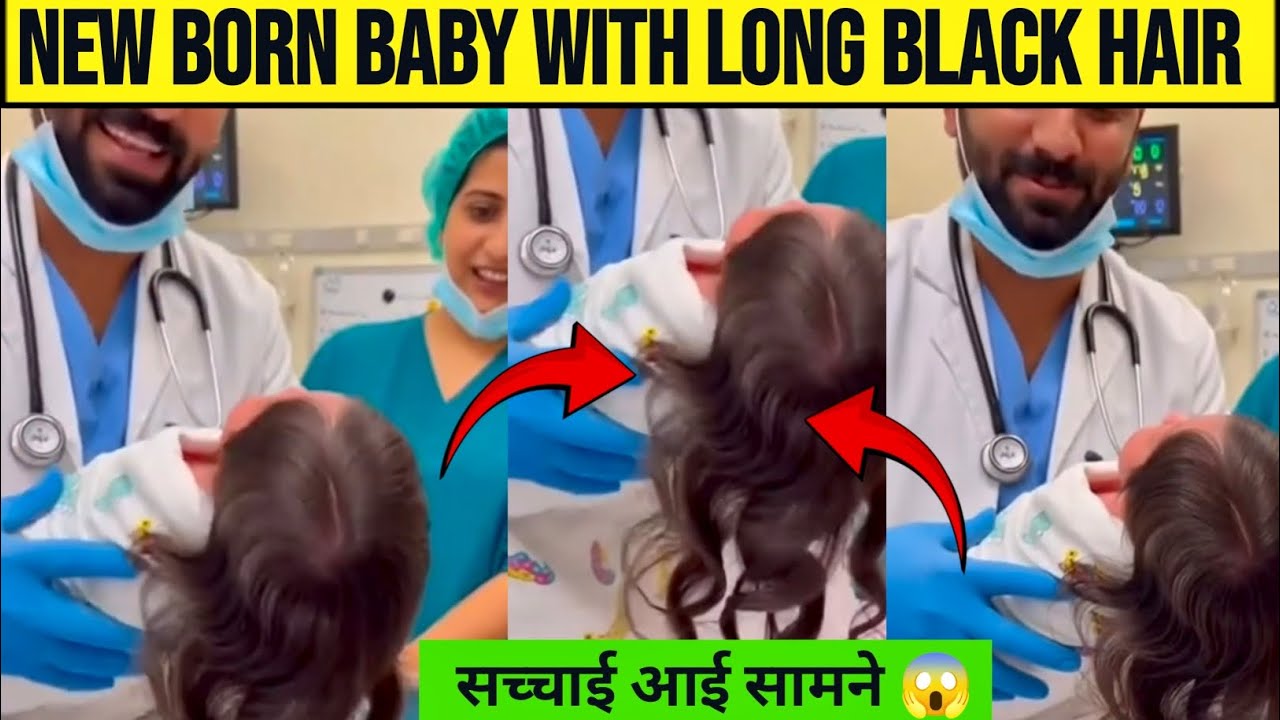 New born baby with long black hair | viral video baby born with long hair 
