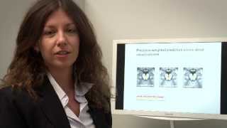 Hierarchical Prediction Errors in Sensory Learning