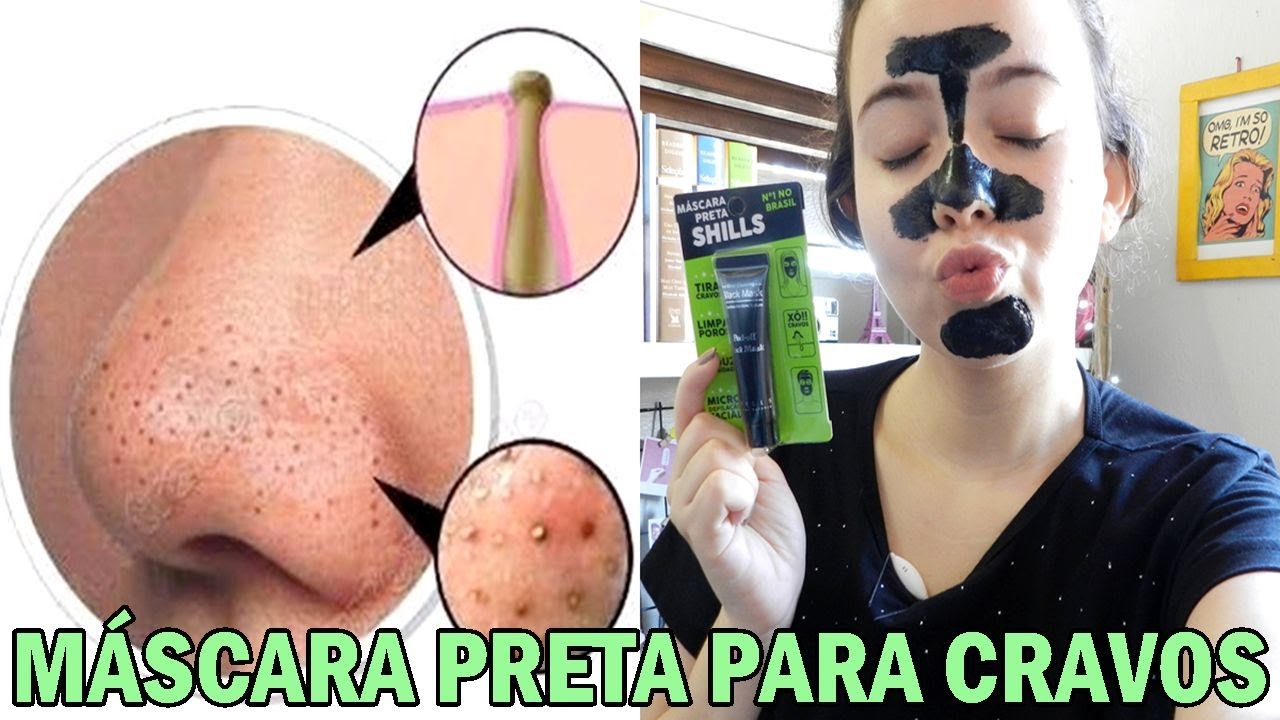 Mascara Para Tirar Pontos Pretos Caseiro
