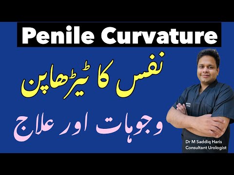 Nafs Ka Terha Pan Ki Wajoohat Aur Ilaj Peyronie S Disease Penile Curvature