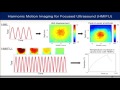 Payen - Pancreatic tumor monitoring and treatment using HMIFU in a transgenic mouse model (2016)