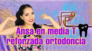 ANSA EN MEDIA T REFORZADA ORTODONCIA