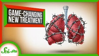 New Cystic Fibrosis Treatment a 