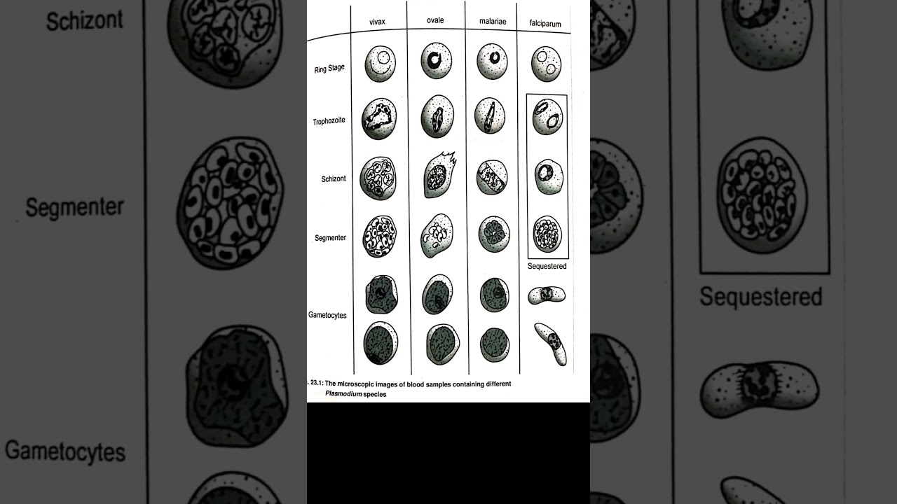 🔥The microscopic images of blood samples containing different plasmodium species🎯 