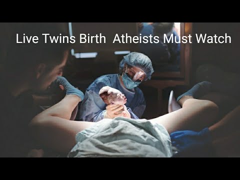 Live Twins Birth  Atheists Must Watch  Paulraj P  PaulrajTubes