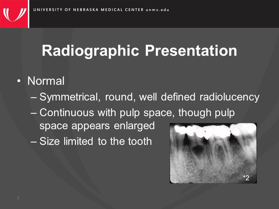Internal Resorption Radiograph