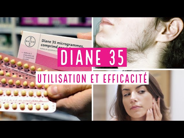 DIANE 35 TOUT CE QUE VOUS DEVEZ SAVOIR - YouTube