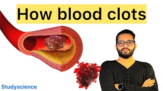 Why You Don’t Bleed Forever | The Complete Coagulation Cascade