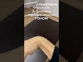 #ГИГРОМА #ТИМFOHOW #89263168875