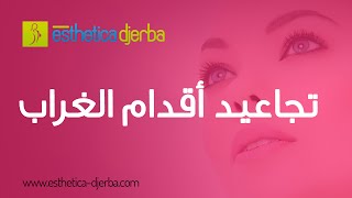 تجاعيد أقدام الغراب جربة  تونس - الهاتف : 246 621 75 216+