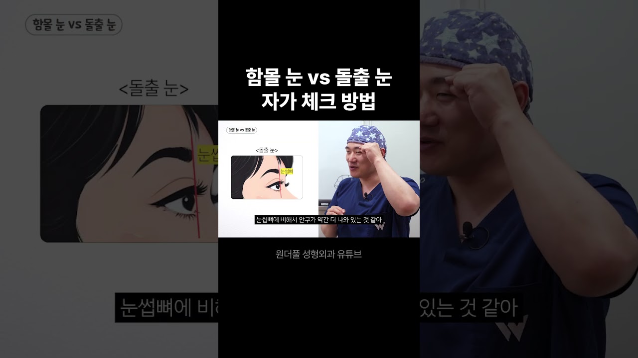 [Вондэрфүл Гоо сайхны мэс заслын эмнэлэг] Хонхойсон нүд ба Овойсон нүд, Өөрөө шалгах арга