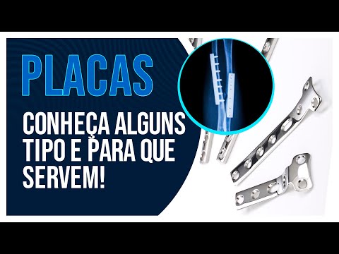 Vídeo: Para que servem as placas de calcanhar?