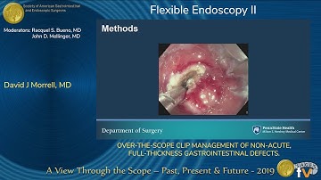 ENDOSCOPIC MANAGEMENT OF RECURRENT ANASTOMOTIC LEAK FOLLOWING CHEMOTHERAPY AFTER COLORECTAL SURGERY