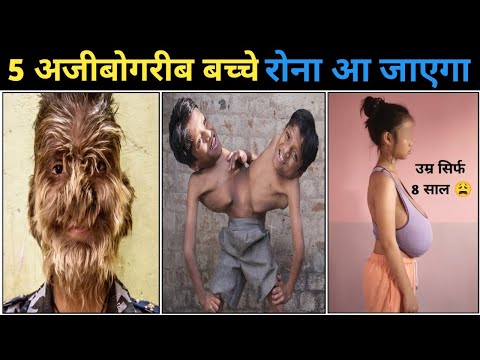 दुनिया के 5 सबसे अजीबोगरीब बच्चे | Most Unusual Kids In The World | Alxenedra Siang | Yumi Ballarta